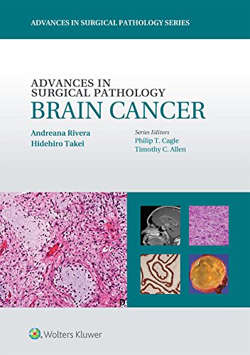 9781451190915: Advances in Surgical Pathology Brain Cancer