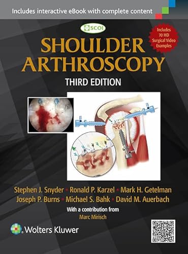 9781451191707: Shoulder Arthroscopy