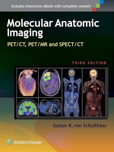 9781451192667: Molecular Anatomic Imaging: PET/CT, PET/MR and SPECT/CT