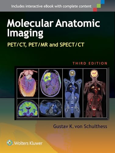 Stock image for Molecular Anatomic Imaging 3Ed (Hb 2016) for sale by Basi6 International