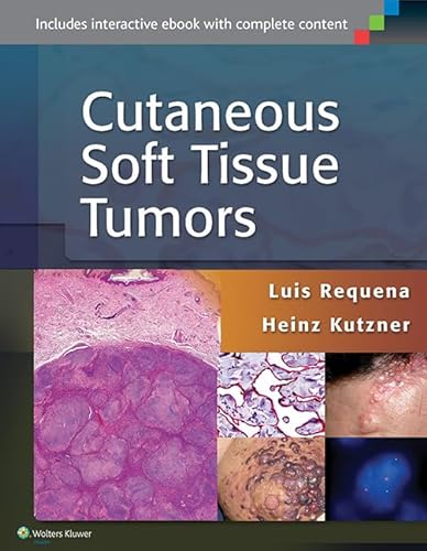 9781451192766: Cutaneous Soft Tissue Tumors