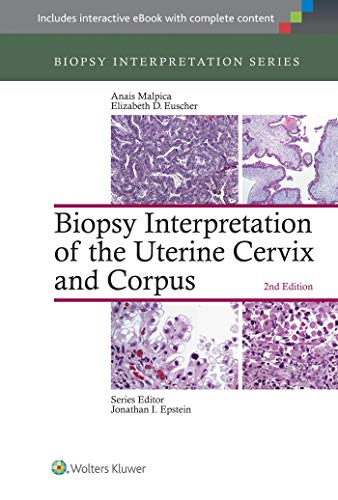 9781451192964: Biopsy Interpretation of the Uterine Cervix and Corpus