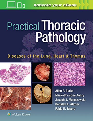 Beispielbild fr Practical Thoracic Pathology: Diseases of the Lung, Heart, and Thymus zum Verkauf von Buchmarie