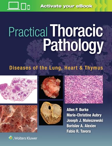 Stock image for Practical Thoracic Pathology: Diseases of the Lung, Heart, and Thymus for sale by Scubibooks