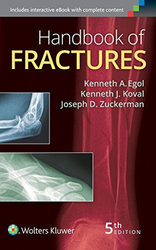 Beispielbild fr Handbook of Fractures zum Verkauf von Byrd Books