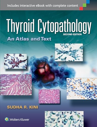 Imagen de archivo de Thyroid Cytopathology: An Atlas and Text a la venta por Scubibooks