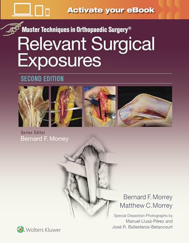 Stock image for Master Techniques in Orthopaedic Surgery: Relevant Surgical Exposures for sale by Scubibooks