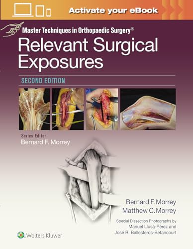 9781451194067: Master Techniques in Orthopaedic Surgery: Relevant Surgical Exposures