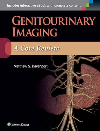 Beispielbild fr Genitourinary Imaging: a Core Review zum Verkauf von Better World Books