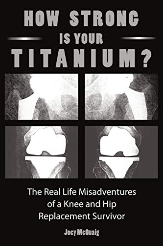 9781452037028: How Strong Is Your Titanium: The Real Life Misadventures of a Knee and Hip Replacement Survivor