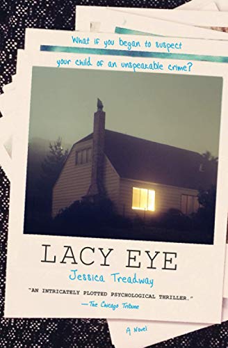 9781455554089: Lacy Eye