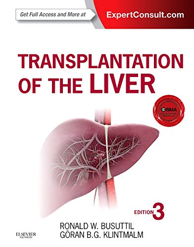 9781455702688: Transplantation of the Liver: Expert Consult - Online and Print, 3e