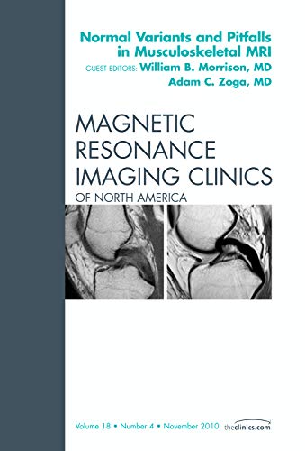 Imagen de archivo de Normal Variants and Pitfalls in Musculoskeletal MRI, An Issue of Magnetic Resonance Imaging Clinics (Volume 18-4) (The Clinics: Radiology, Volume 18-4) a la venta por BooksRun