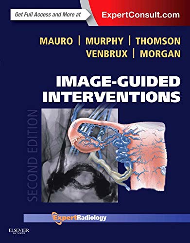 Imagen de archivo de Image-Guided Interventions: Expert Radiology Series (Expert Consult - Online and Print) a la venta por HPB-Red