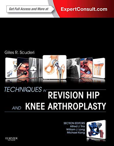 Beispielbild fr Techniques in Revision Hip and Knee Arthroplasty zum Verkauf von HPB-Red
