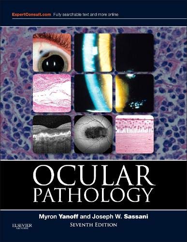 9781455728749: Ocular Pathology, Expert Consult - Online and Print, 7th Edition