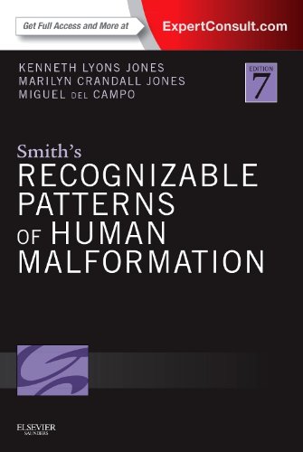 9781455738113: Smith's Recognizable Patterns of Human Malformation: Expert Consult - Online and