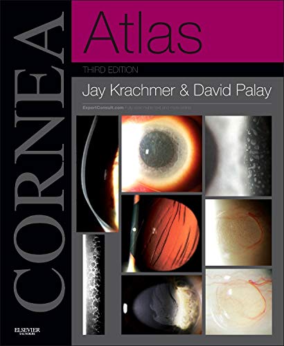 9781455740604: Cornea Atlas: Expert Consult - Online and Print, 3e