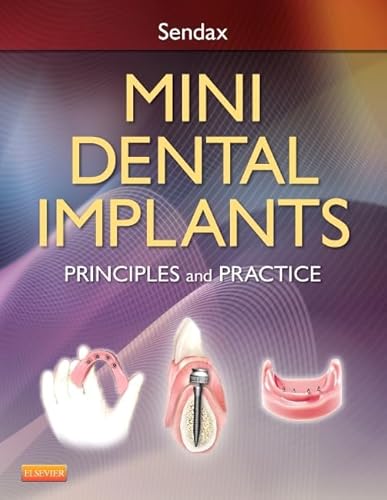 9781455743865: Mini Dental Implants: Principles and Practice