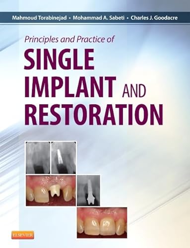 Stock image for Principles and Practice of Single Implant and Restoration for sale by Solr Books