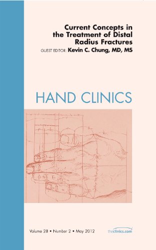 Stock image for Current Concepts in the Treatment of Distal Radius Fractures, an Issue of Hand Clinics: Volume 28-2 for sale by ThriftBooks-Dallas