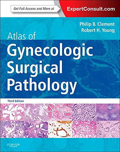 Beispielbild fr Atlas of Gynecologic Surgical Pathology: Expert Consult: Online and Print, 3e zum Verkauf von dsmbooks