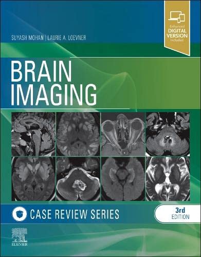 Beispielbild fr Brain Imaging Case Review zum Verkauf von AG Library