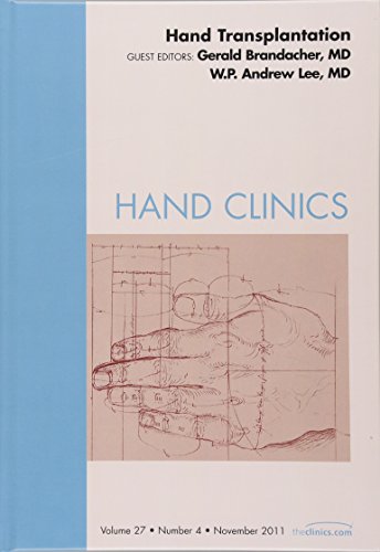 Imagen de archivo de Hand Transplantation, An Issue of Hand Clinics (The Clinics: Orthopedics) a la venta por Chiron Media
