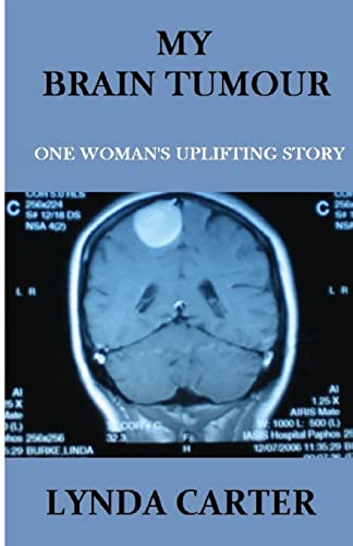 Imagen de archivo de My Brain Tumour: One Woman's Uplifting Story a la venta por Save With Sam