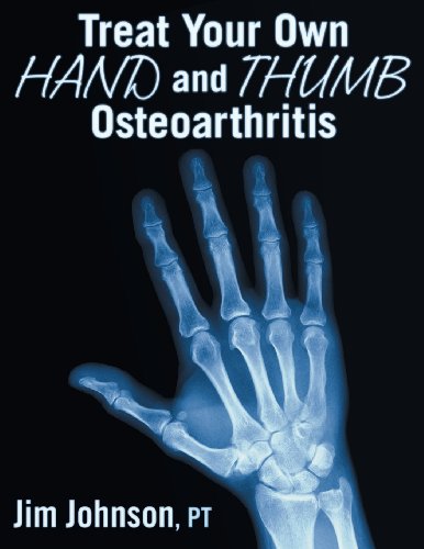 Stock image for Treat Your Own Hand and Thumb Osteoarthritis for sale by Books of the Smoky Mountains