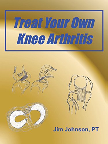 9781457540172: Treat Your Own Knee Arthritis