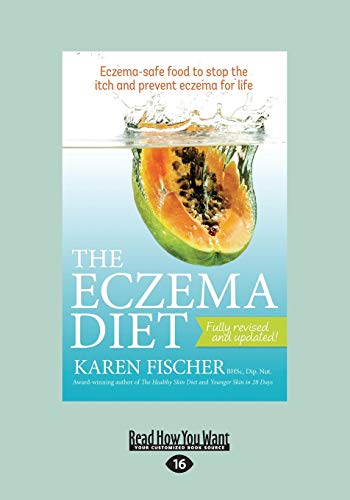 Stock image for The Eczema Diet Eczema-Safe Food To Stop: Eczema-Safe Food to Stop The Itch and Prevent Eczema for Life for sale by Shopbookaholic Inc