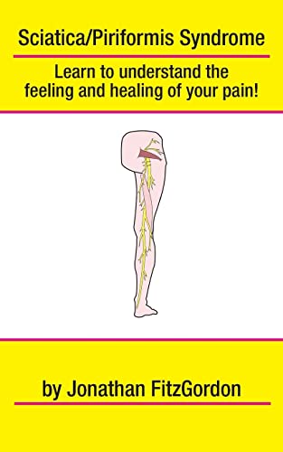 9781461109709: Sciatica/ Piriformis Syndrome- What, Where, How & Why: Learn to understand the feeling and healing of your pain!