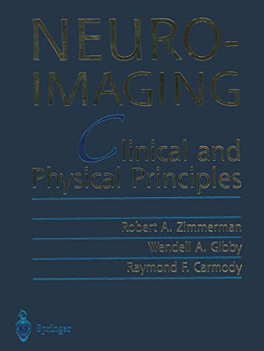 9781461270256: Neuroimaging: Clinical and Physical Principles