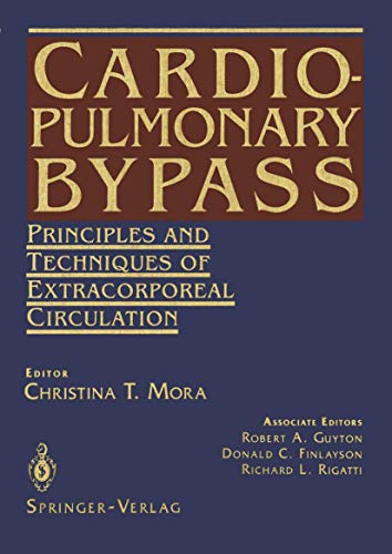 9781461275572: Cardiopulmonary Bypass: Principles and Techniques of Extracorporeal Circulation