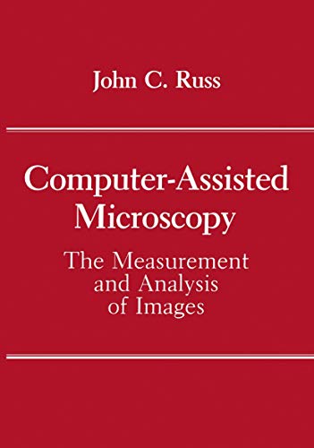 9781461278689: Computer-Assisted Microscopy: The Measurement And Analysis Of Images