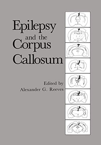Imagen de archivo de Epilepsy and the Corpus Callosum a la venta por Lucky's Textbooks