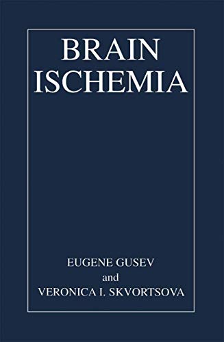 Imagen de archivo de Brain Ischemia a la venta por Lucky's Textbooks