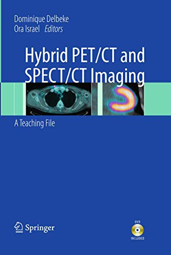 9781461400905: Hybrid PET/CT and SPECT/CT Imaging: A Teaching File