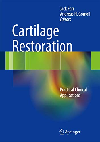 Imagen de archivo de Cartilage Restoration. Practical Clinical Applications. a la venta por Gast & Hoyer GmbH