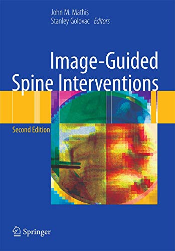 Stock image for Image-Guided Spine Interventions for sale by THE SAINT BOOKSTORE