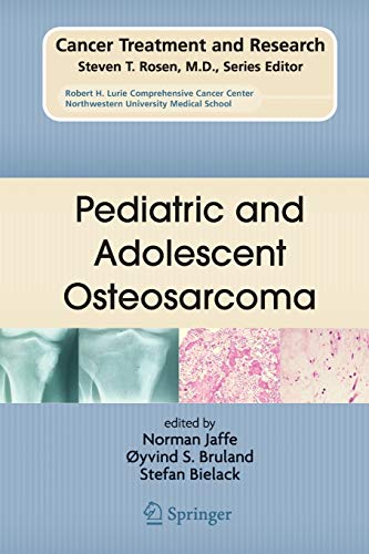 9781461424697: Pediatric and Adolescent Osteosarcoma: 152 (Cancer Treatment and Research)