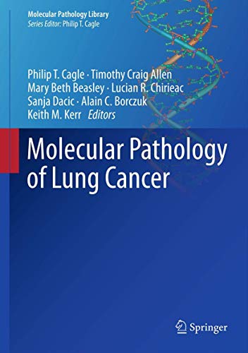 9781461431961: Molecular Pathology of Lung Cancer: 6 (Molecular Pathology Library)