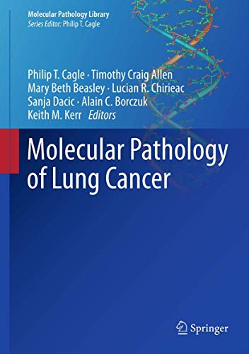 9781461431961: Molecular Pathology of Lung Cancer: 6