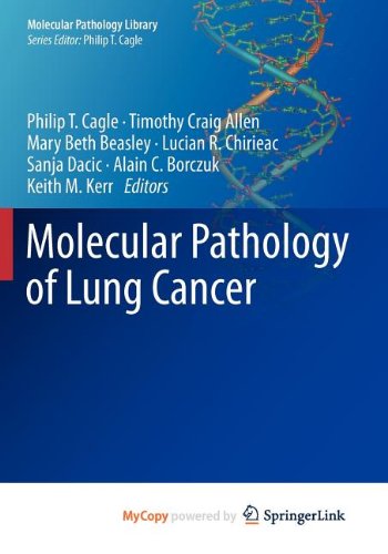 9781461431985: Molecular Pathology of Lung Cancer