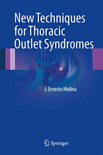 Imagen de archivo de New Techniques for Thoracic Outlet Syndromes a la venta por Wizard Books