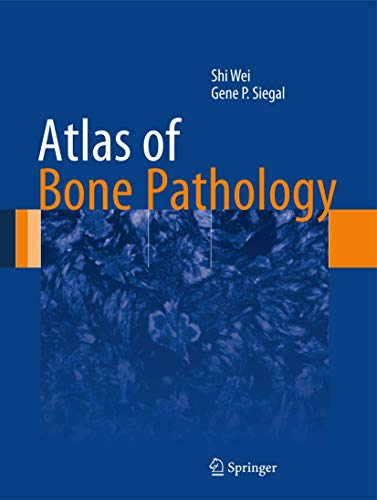 Stock image for Atlas of Bone Pathology for sale by Buchpark