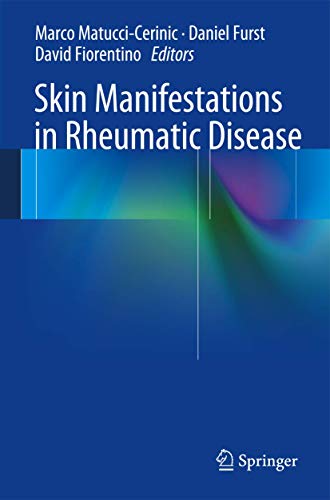 9781461478485: Skin Manifestations in Rheumatic Disease
