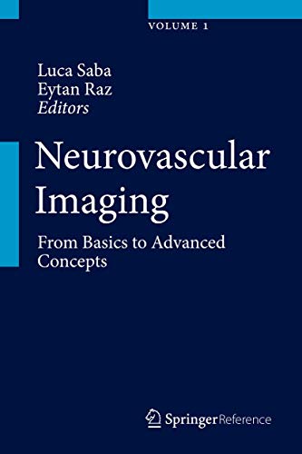 9781461490302: Neurovascular Imaging: From Basics to Advanced Concepts