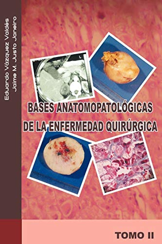 Stock image for BASES ANATOMOPATOLOGICAS DE LA ENFERMEDAD QUIRURGICA (tomo II) for sale by KALAMO LIBROS, S.L.